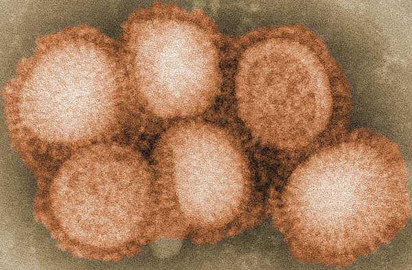 Asiatische Grippe Epidemie